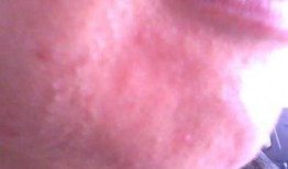 吃瓜之后唇边痒,揭秘背后的健康密码