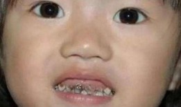 吃瓜把牙齿咬坏了,牙齿“咬”出健康危机