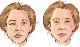 面瘫可以吃角瓜吗,营养滋补助康复