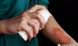 烫伤可以吃嫩瓜吗,嫩瓜的适宜食用指南