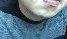 吃白瓜嘴角疼,揭秘瓜果食用小贴士