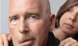 面瘫可以吃角瓜吗,营养滋补助康复